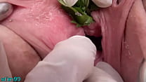best xray nettles in peehole urethral insertion nettles fisting cunt best