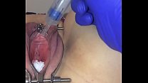 best dougter female catheter tutorial best